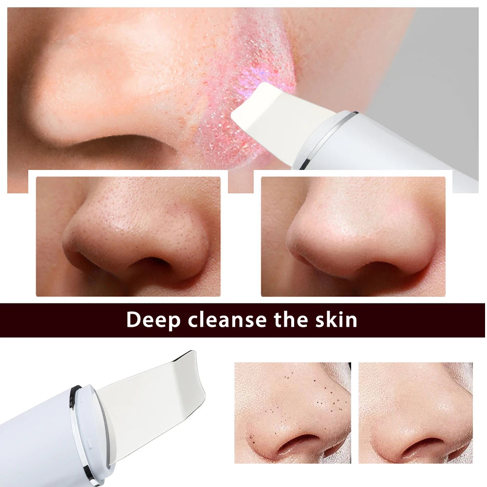 PoreSonic Glow Scrubber – Ultrasonic Facial Pore Cleaner